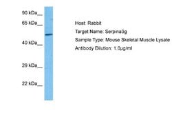 Spi2A Rabbit anti-Mouse, Polyclonal, Novus Biologicals 0.1 mL | Buy Online | Novus Biologicals | Fisher Scientific